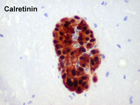 Image 4 Calretinin