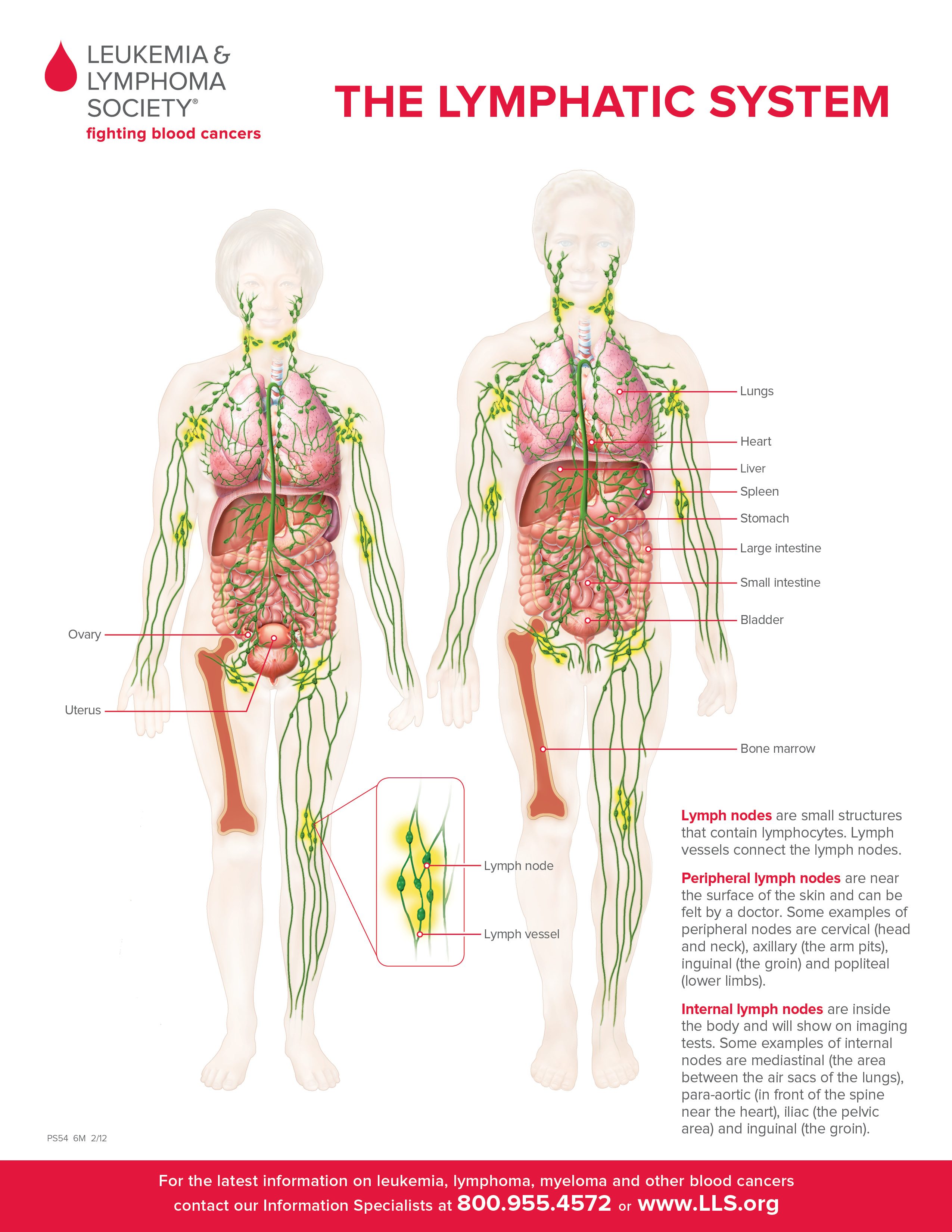 Arm/Leg Lymphedema (Swelling)