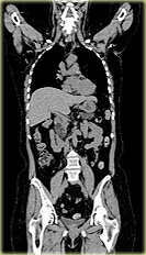 What a normal CT scan looks like