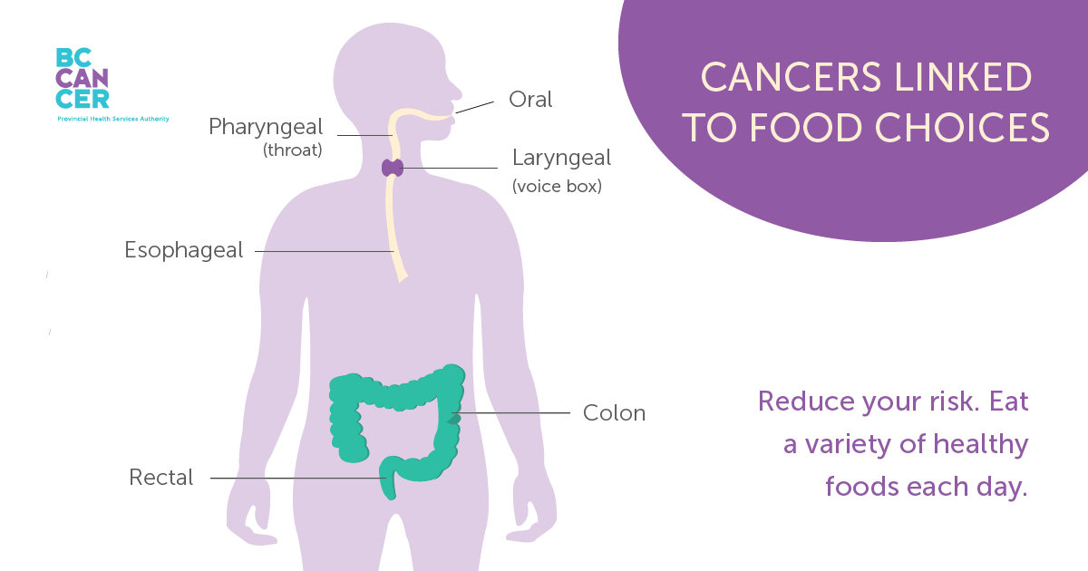 Cancers linked to food choices
