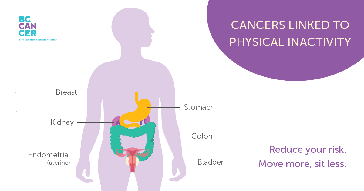 Cancers linked to physical inactivity