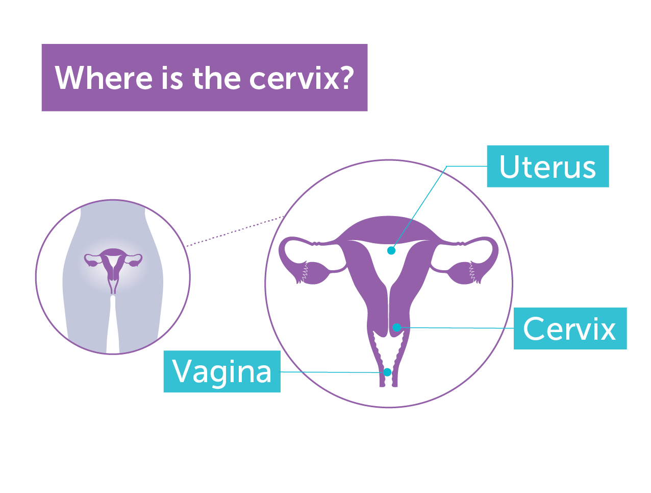 Where-Is-The-Cervix_WhiteBG.png