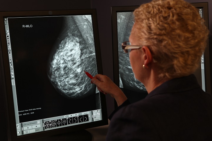 Education materials for health care providers are available at no charge from Screening Programs.