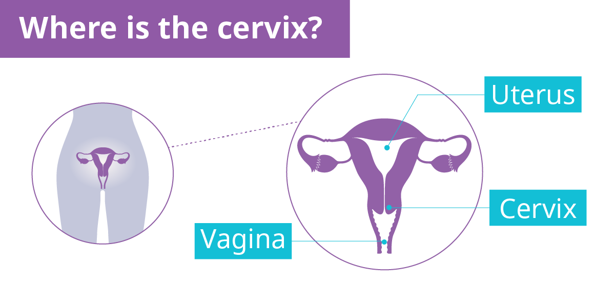Where-is-the-cervix.png